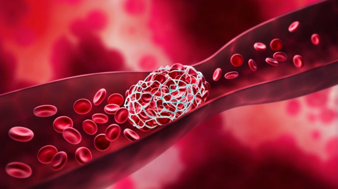 Five-Warning-Signs-of-Atrial-Fibrillation-Everyone-Should-Know.jpg
