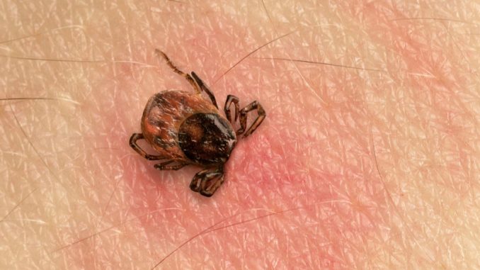 Its-Tick-Season-Warning-Signs-of-Lyme-Disease-to-Know.jpg