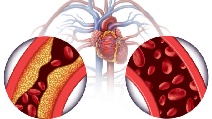 Warning-About-Different-Blood-Pressures-in-Right-and-Left-Arms.jpg